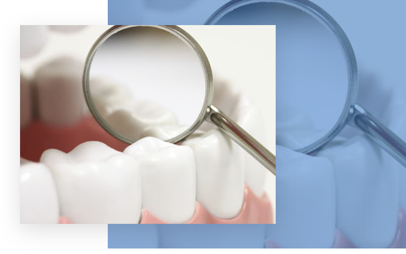 dental sealants north austin 