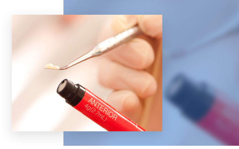 composite filling | Rock Ridge Dental