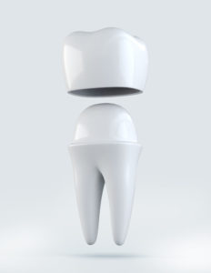 DENTAL CROWNS